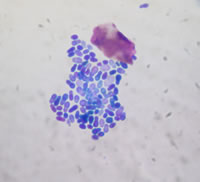 Mikroskopisches Bild von Malassezien